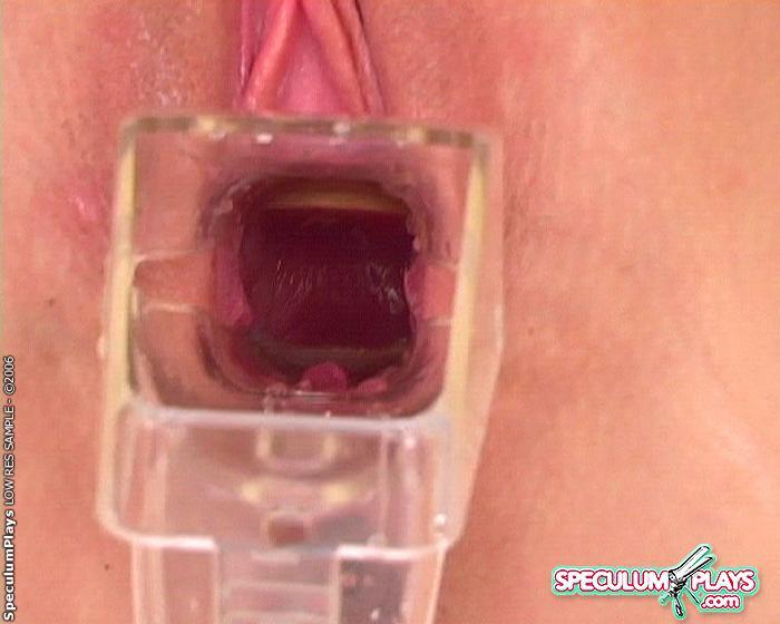 Speculum Insertion Video